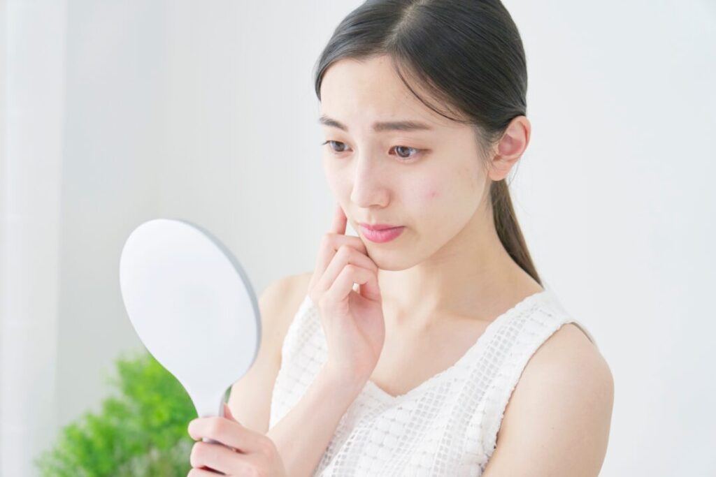 肌荒れ解消に効果的なパワーストーン 天然石をご紹介!嫌な肌トラブルのお悩み解決!~綺麗な美肌に~